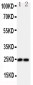 Anti-FGF19 Antibody