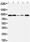 Anti-FGFR1 Antibody