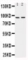 Anti-ADAMTS4 Antibody