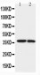 Anti-IGFBP-1 Antibody