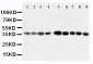 Anti-AIMP2/p38 Antibody