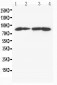 Anti-MTA1 Antibody