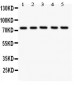 Anti-12 Lipoxygenase Antibody