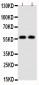 Anti-Alpha Amylase 1 Antibody