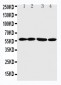 Anti-ANGPTL1 Antibody