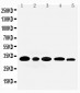 Anti-Aquaporin 3 Antibody