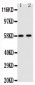 Anti-Aromatase Antibody