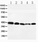 Anti-GPR2/CCR10 Antibody