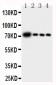 Anti-GCLC Antibody