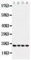 Anti-IFN gamma Antibody