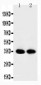 Anti-APE1 Antibody