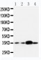 Anti-APE1 Antibody