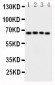 Anti-CAMKK2 Antibody