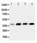 Anti-IGFBP-3 Antibody