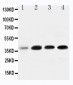 Anti-IGFBP-3 Antibody