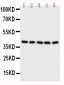 Anti-BCAT2 Antibody