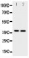 Anti-MCL1 Antibody