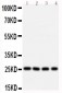 Anti-Bcl10 Antibody