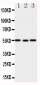 Anti-XIAP Antibody