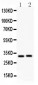 Anti-IL-1 beta Antibody