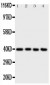 Anti-ATF4 Antibody