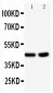 Anti-BCAT1 Antibody