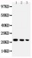 Anti-BAFF Antibody