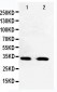 Anti-Cdk5 Antibody