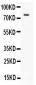 Anti-hCG Receptor Antibody