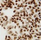 Anti-CTBP2 Antibody