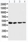 Anti-Cystathionase Antibody