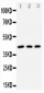 Anti-DAP Kinase 2 Antibody