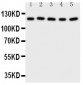 Anti-Desmoglein 2 Antibody