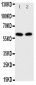 Anti-E2F1 Antibody