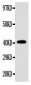 Anti-EDA Antibody