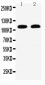 Anti-Desmoglein 3 Antibody