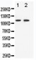 Anti-Eph Receptor B3 Antibody