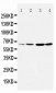 Anti-DRD1 Antibody