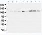 Anti-Eph Receptor A1 Antibody