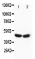 Anti-FOXP3 Antibody