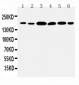 Anti-Laminin Gamma 1 Antibody