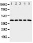 Anti-Prostaglandin E Receptor EP1 Antibody