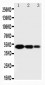 Anti-SPARC Antibody