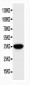 Anti-SPARC Antibody