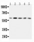 Anti-GRB7 Antibody