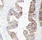 Anti-GST3/GST Pi Antibody