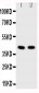 Anti-HDAC8 Antibody