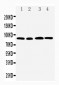 Anti-CD168 Antibody