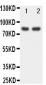 Anti-FOXP1 Antibody