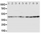 Anti-HDJ2 Antibody